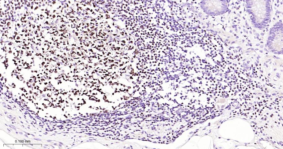 配对盒基因5重组兔单抗