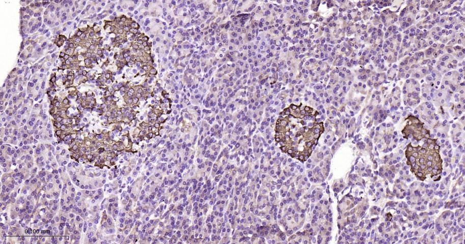 鸟苷酸环化酶β1重组兔单抗