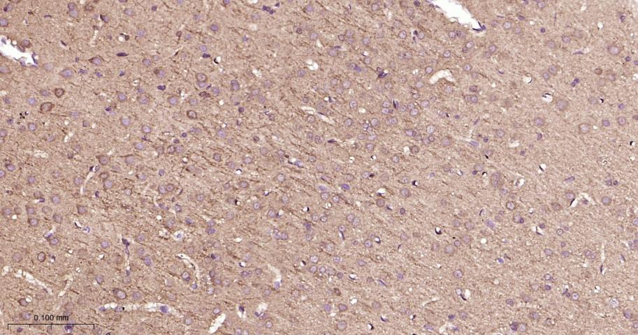 鸟苷酸环化酶β1重组兔单抗