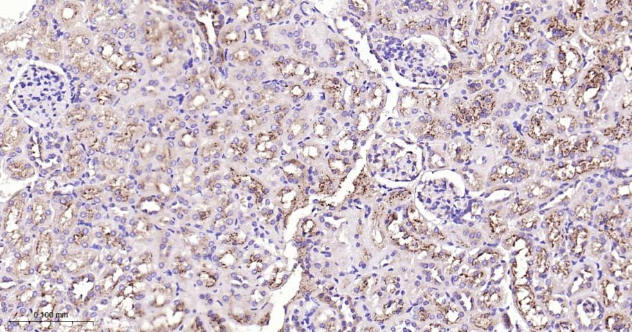 肺耐药相关蛋白重组兔单抗-bsm-61705R