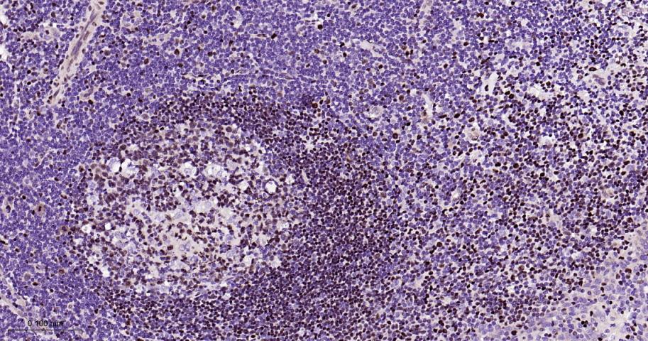 肌细胞增强因子2A/2C重组兔单抗