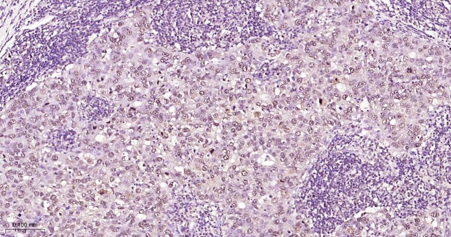 磷酸化信号转导和转录激活因子3单克隆抗体-bsm-33301M