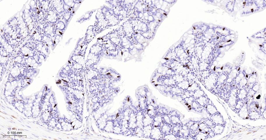 嗜铬粒素A重组兔单抗
