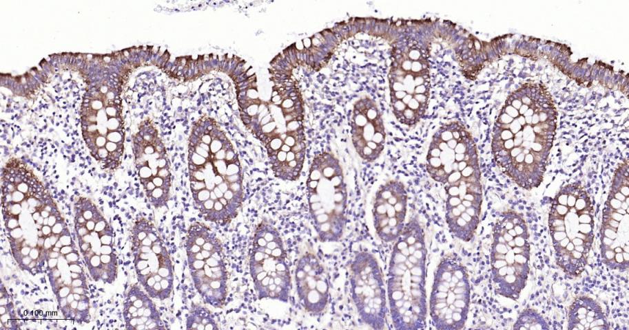 肺耐药相关蛋白重组兔单抗-bsm-61705R