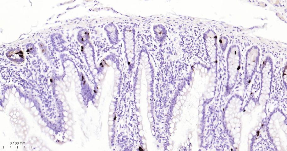 嗜铬粒素A重组兔单抗