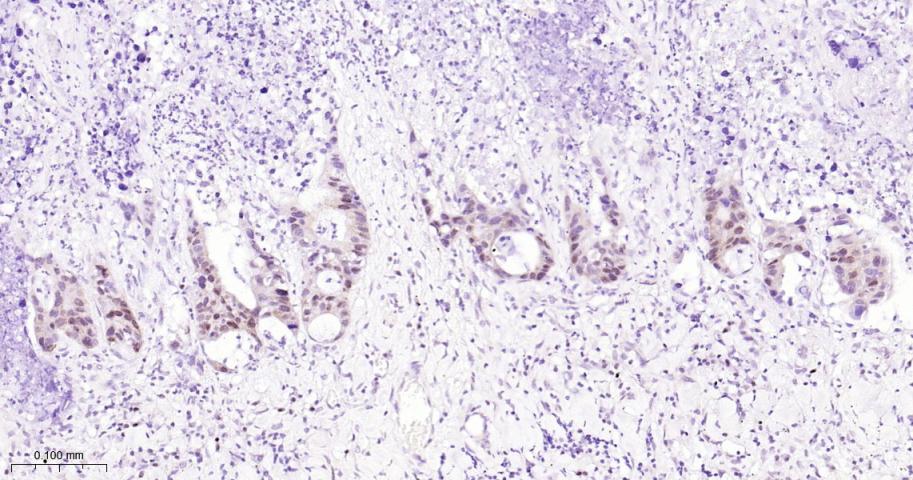 O6甲基鸟嘌呤DNA甲基转移酶重组兔单抗