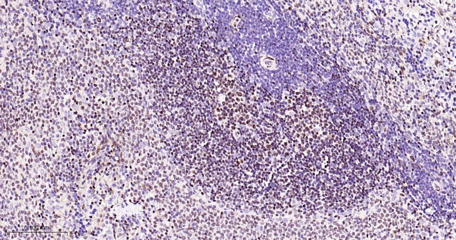 肌细胞增强因子2A/2C重组兔单抗