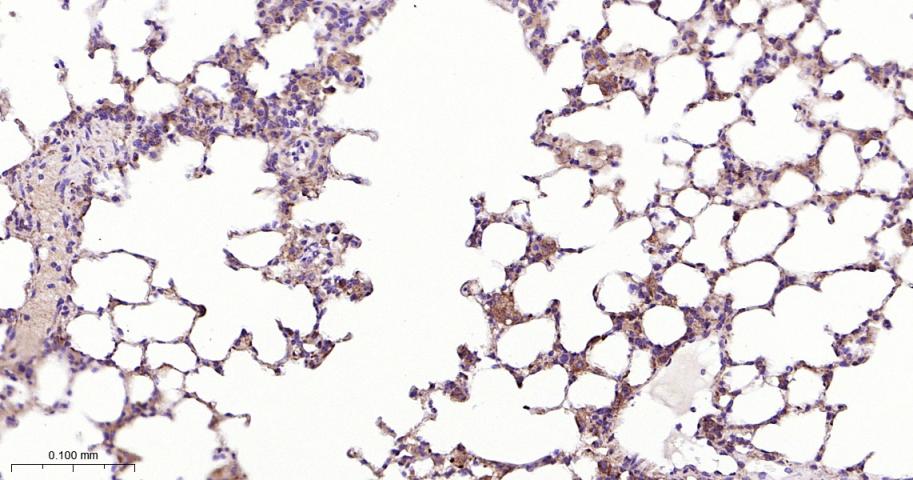 肺耐药相关蛋白重组兔单抗-bsm-61705R