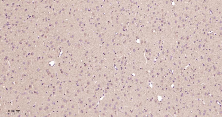 鸟苷酸环化酶β1重组兔单抗