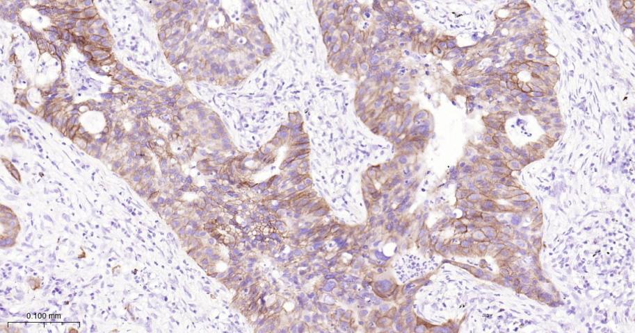 肝细胞生长因子受体重组兔单克隆抗体