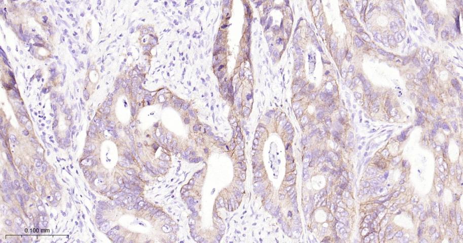 肝细胞生长因子受体重组兔单克隆抗体