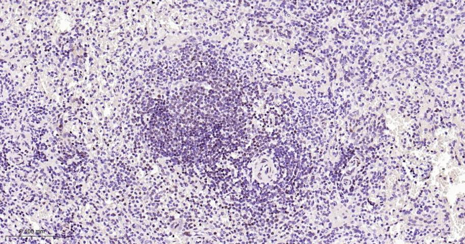肌细胞增强因子2A/2C重组兔单抗
