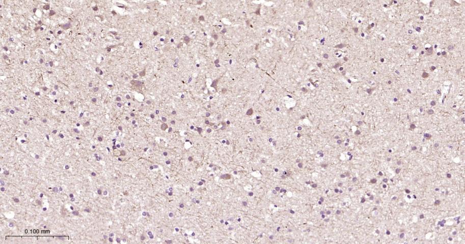 鸟苷酸环化酶β1重组兔单抗