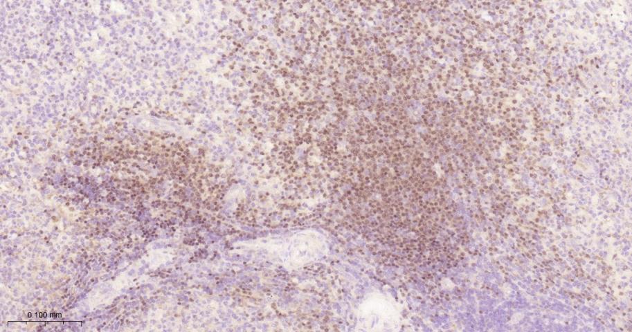 配对盒基因5重组兔单抗