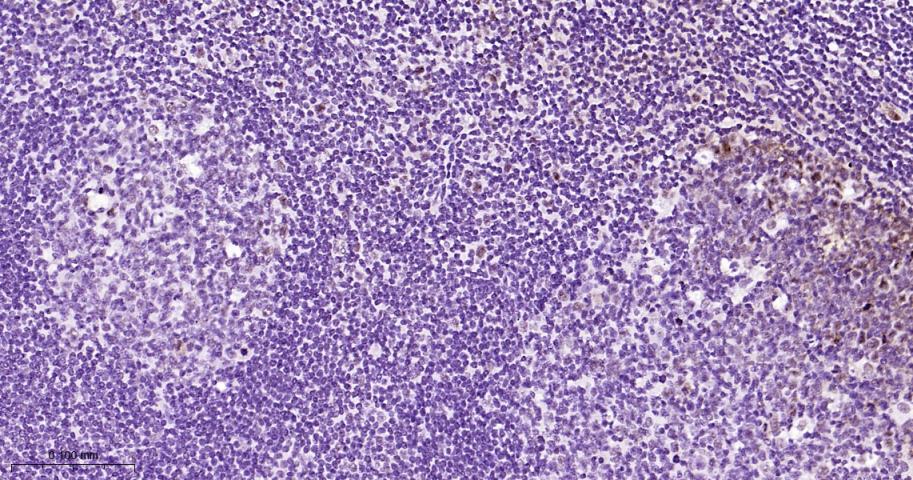 磷酸化信号转导和转录激活因子3单克隆抗体-bsm-33301M