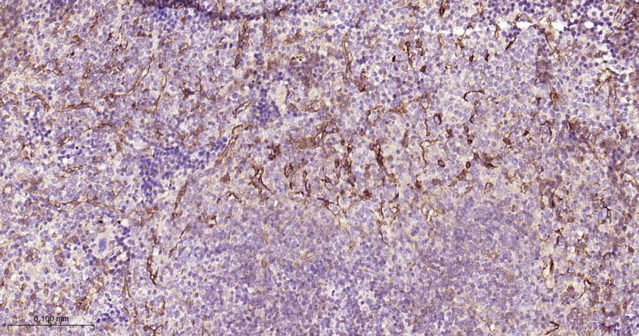 CD105抗体-bs-0579R