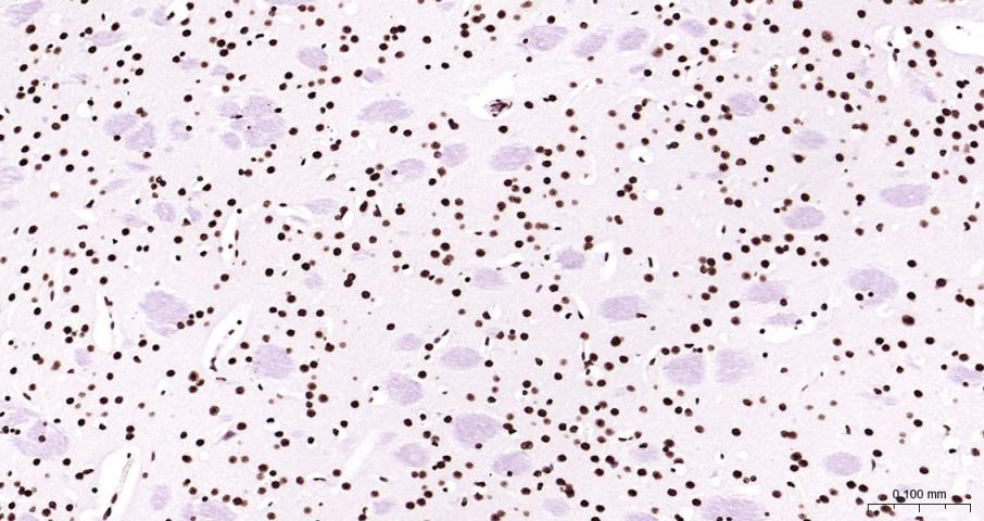 组蛋白H3(核内参)重组兔单抗