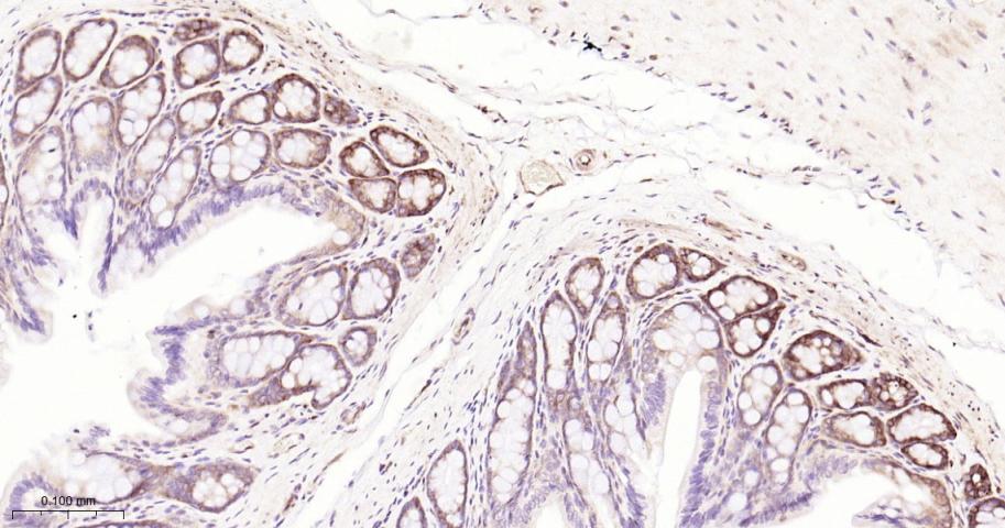 磷酸化真核启动因子2α抗体