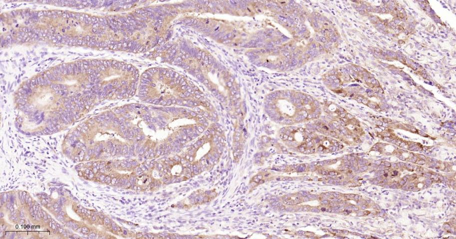 磷酸化真核启动因子2α抗体