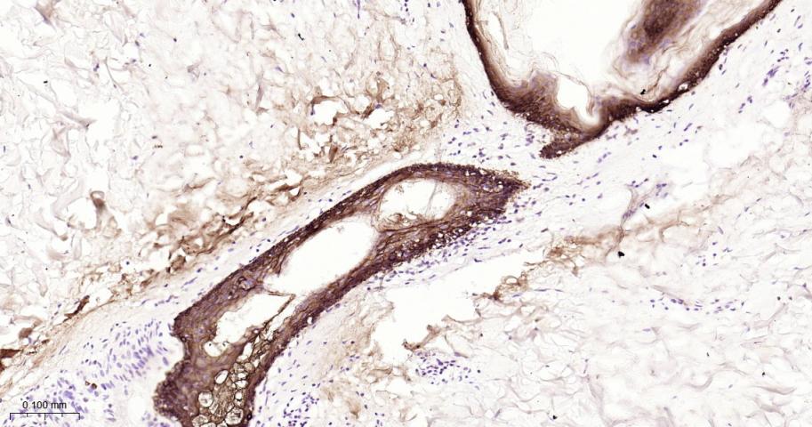 细胞角蛋白16重组兔单抗