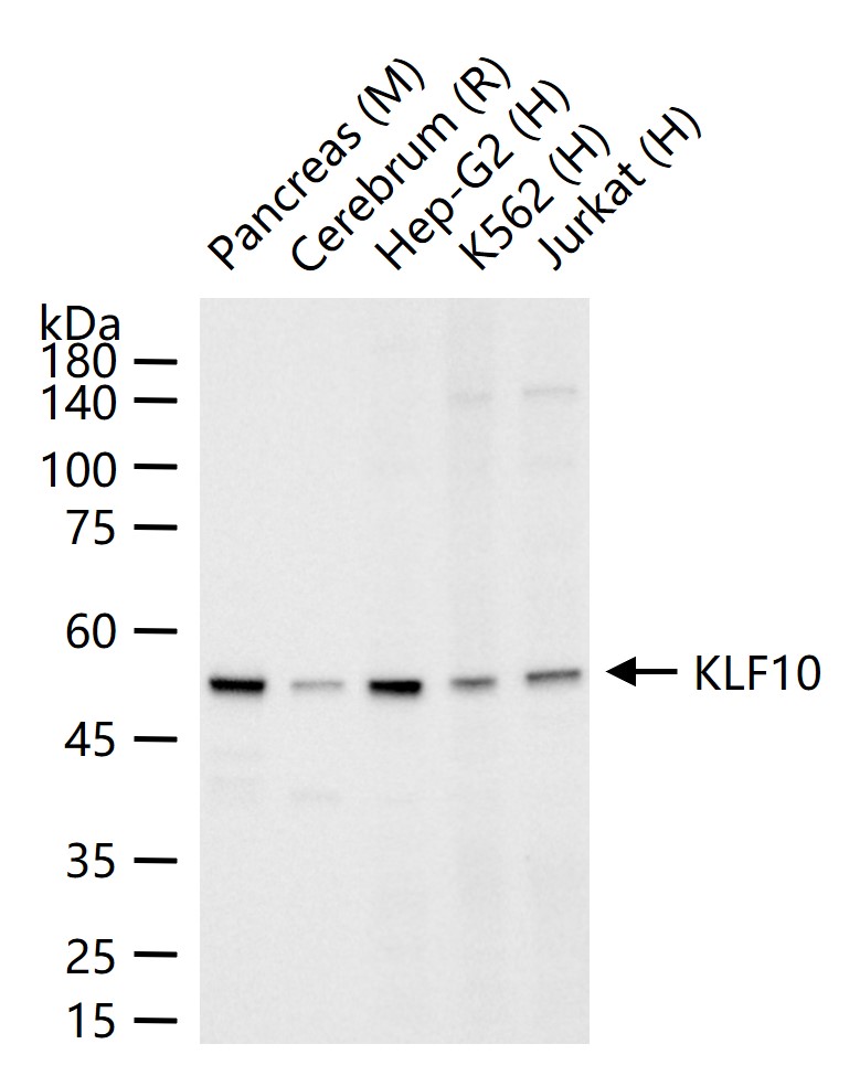 TGF-β诱导早期应答基因1重组兔单抗