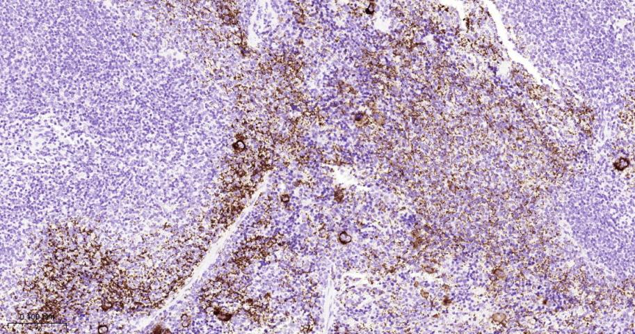 血小板糖蛋白GPIb（CD42b）重组兔单抗