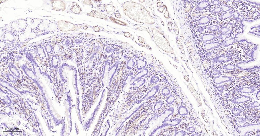 血小板内皮细胞黏附分子1重组兔单抗