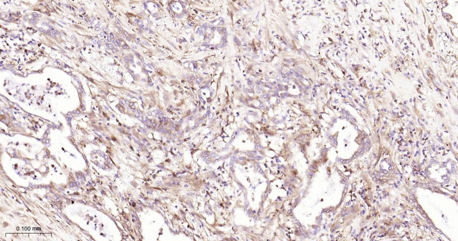 磷酸变位酶1重组兔单抗
