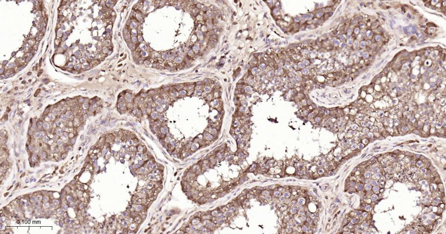 磷酸变位酶1重组兔单抗