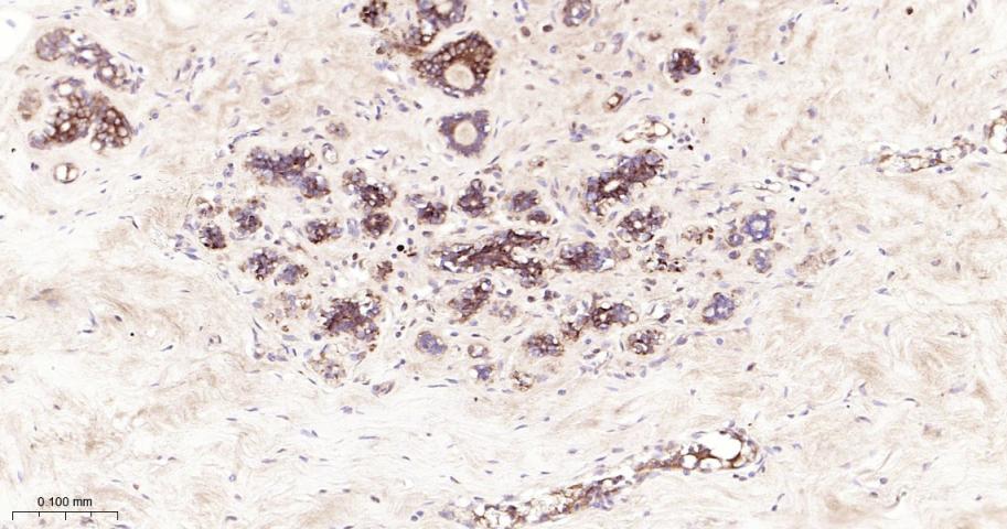 磷酸化真核启动因子2α抗体