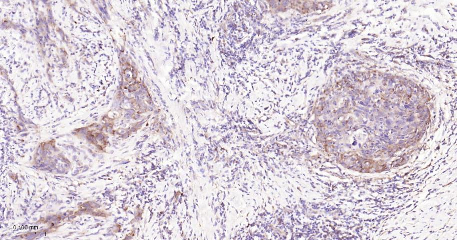 磷酸化真核启动因子2α抗体