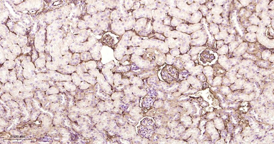 白蛋白重组兔单抗