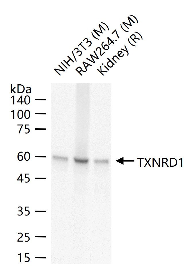 硫氧环蛋白还原酶1重组兔单抗