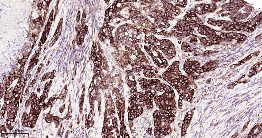 磷酸化真核启动因子2α抗体