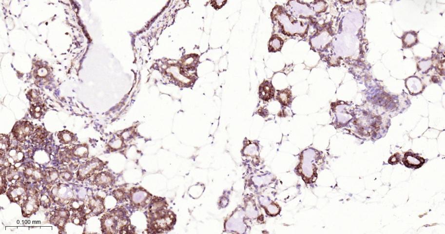 磷酸化真核启动因子2α抗体