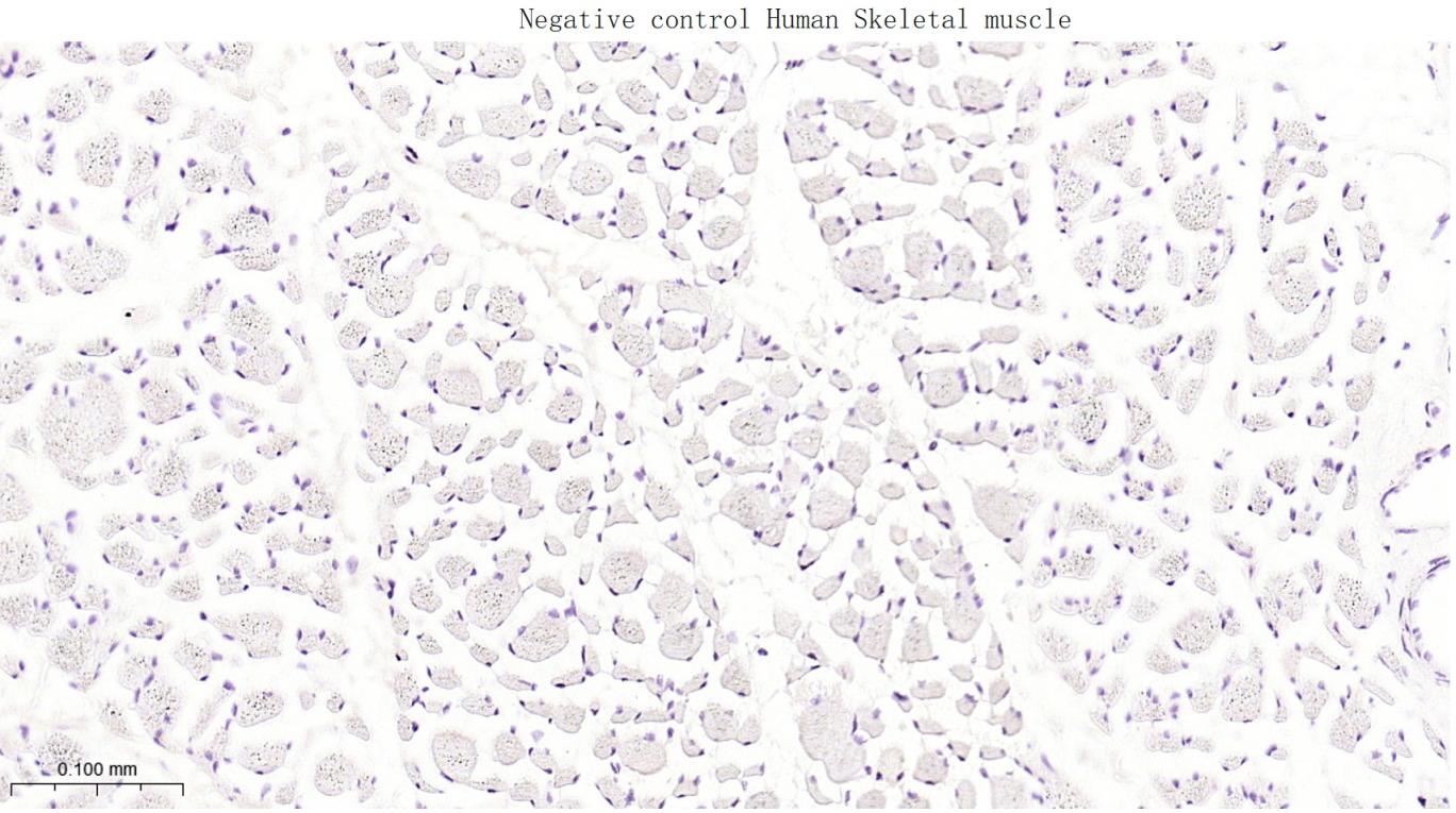 细胞角蛋白16重组兔单抗