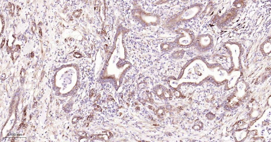 磷酸化真核启动因子2α抗体