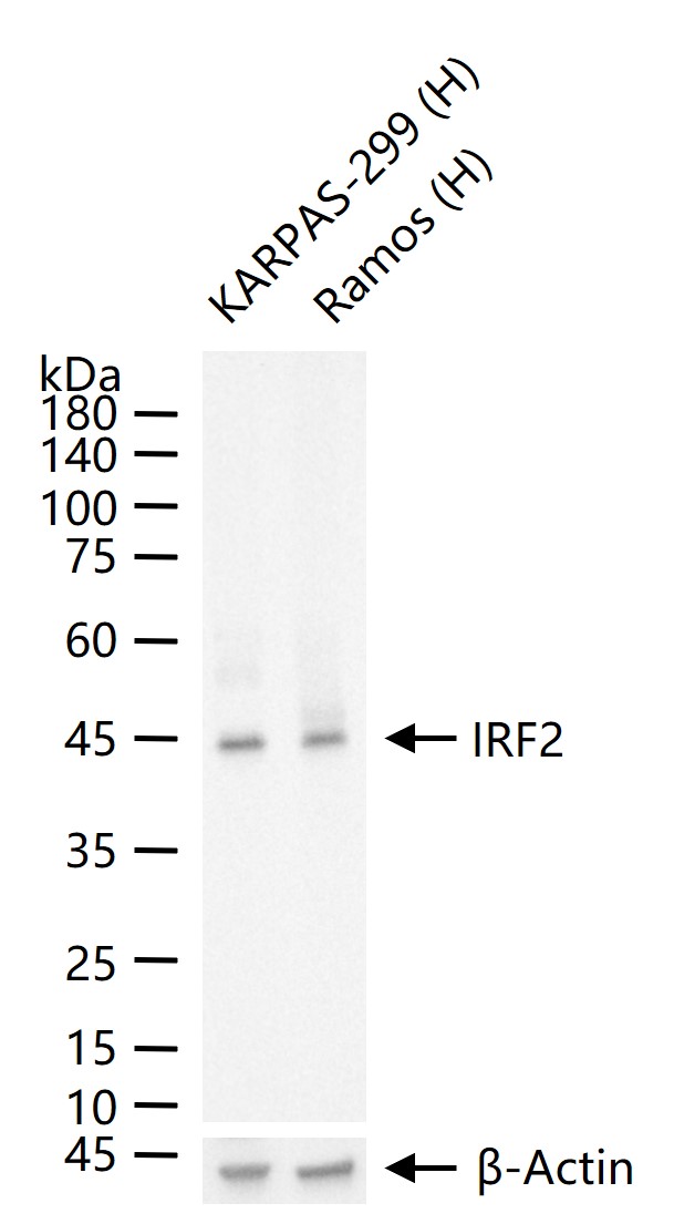 干扰素调节因子2重组兔单抗