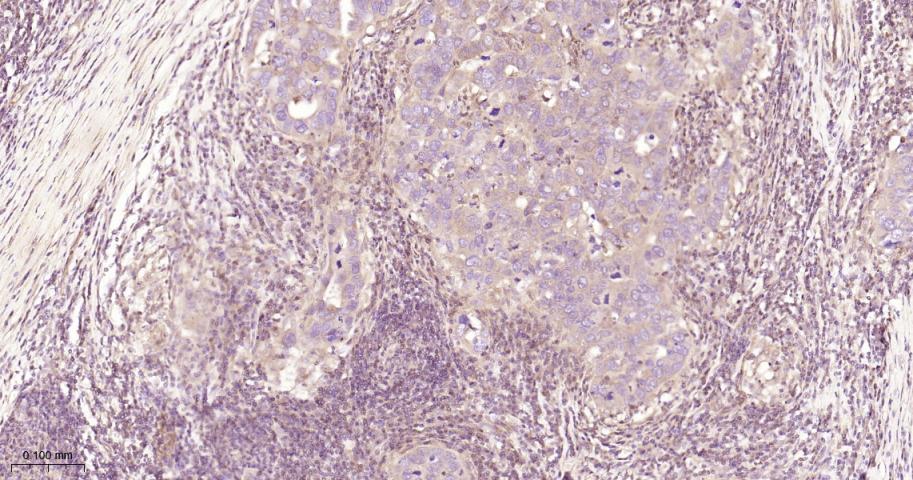磷酸变位酶1重组兔单抗