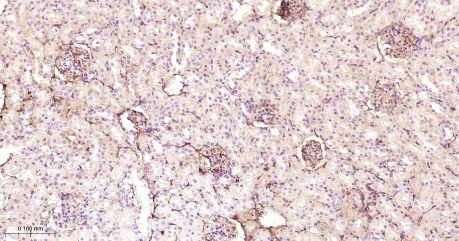 白蛋白重组兔单抗