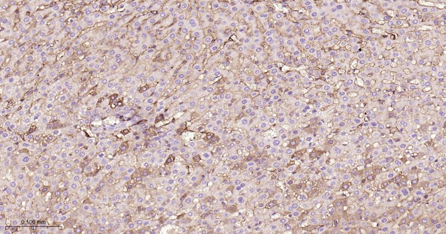 白蛋白重组兔单抗