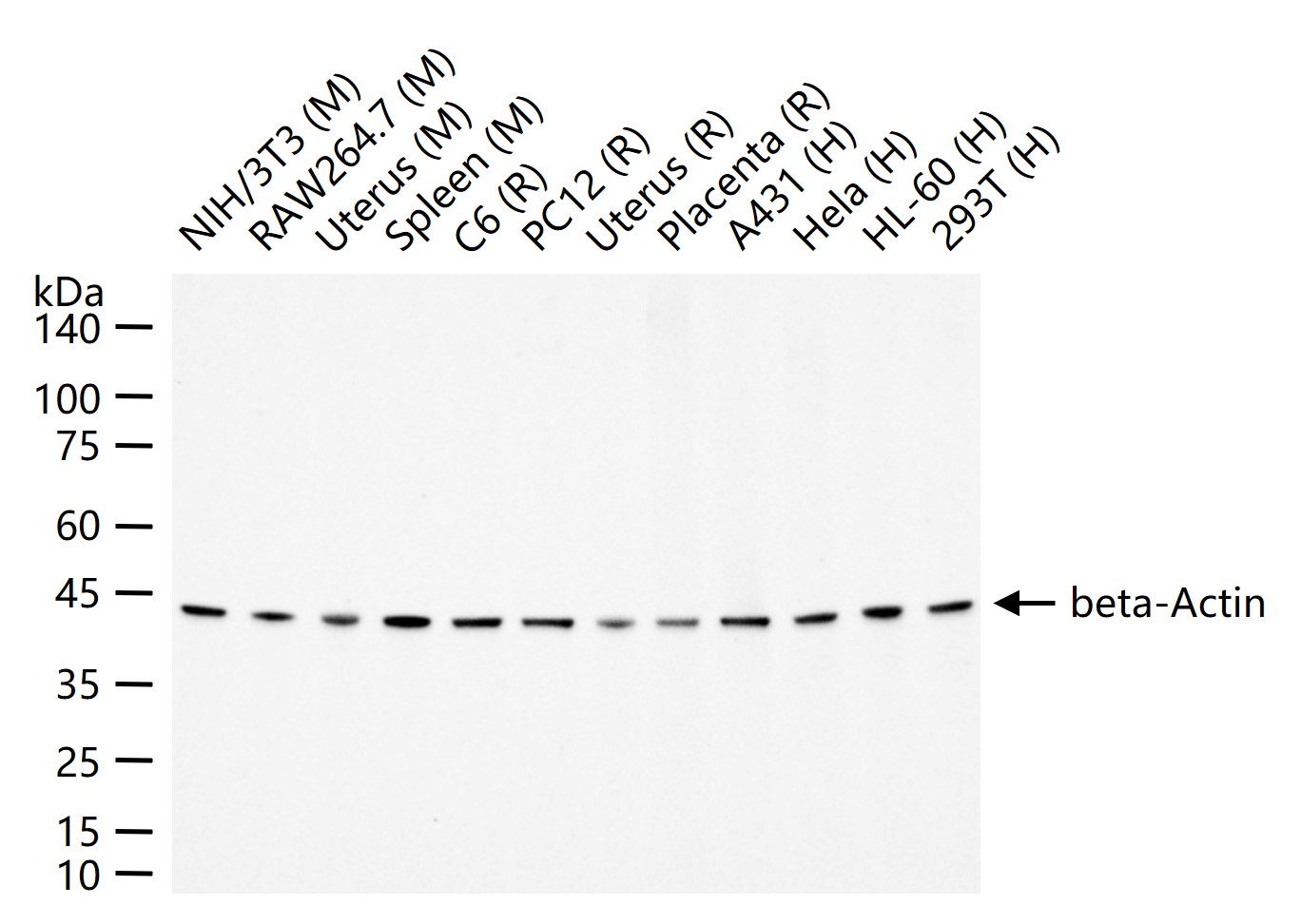 β-肌动蛋白（内参抗体）重组兔单抗