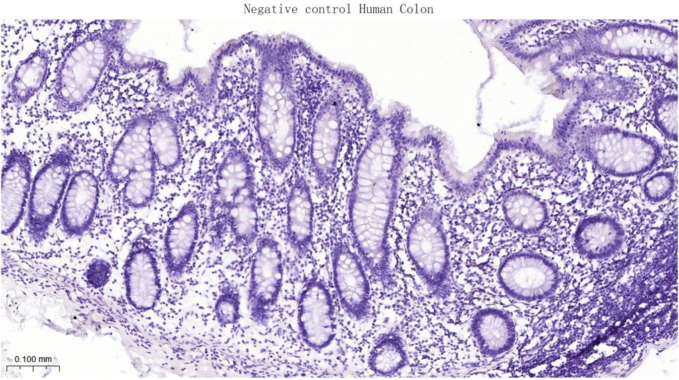 天冬氨酸蛋白酶ASP4重组兔单抗