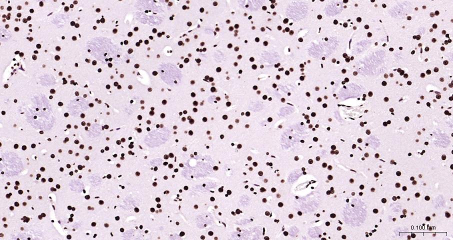 组蛋白H3(核内参)重组兔单抗