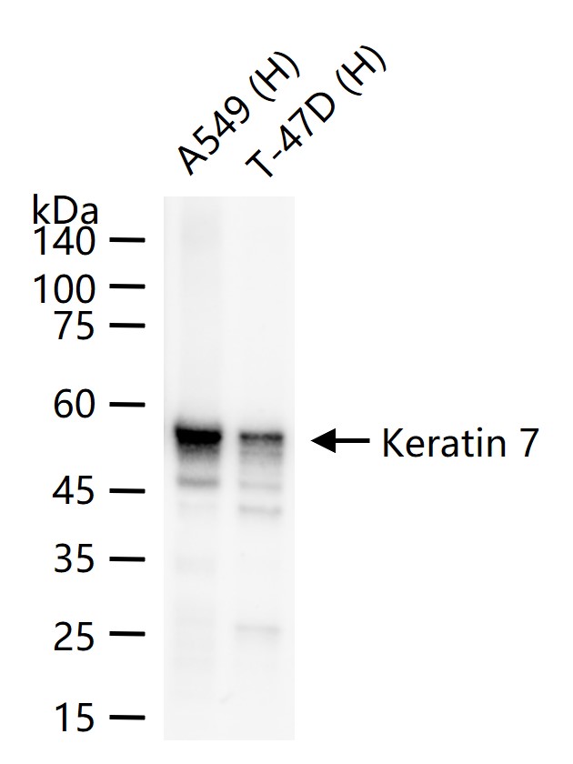 细胞角蛋白7重组兔单抗-bsm-60218R