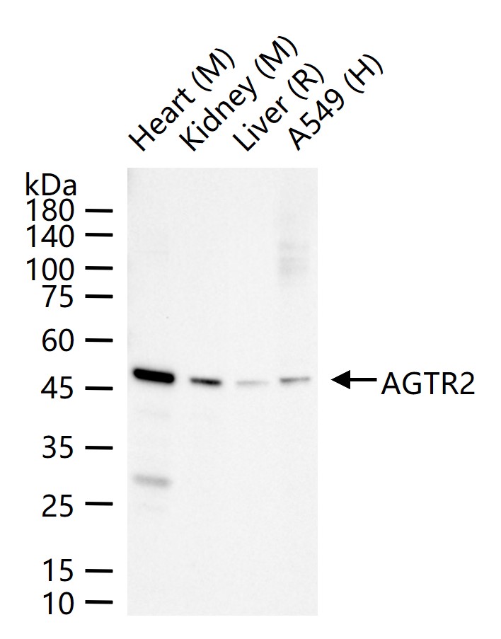 血管紧张素Ⅱ受体2重组兔单抗
