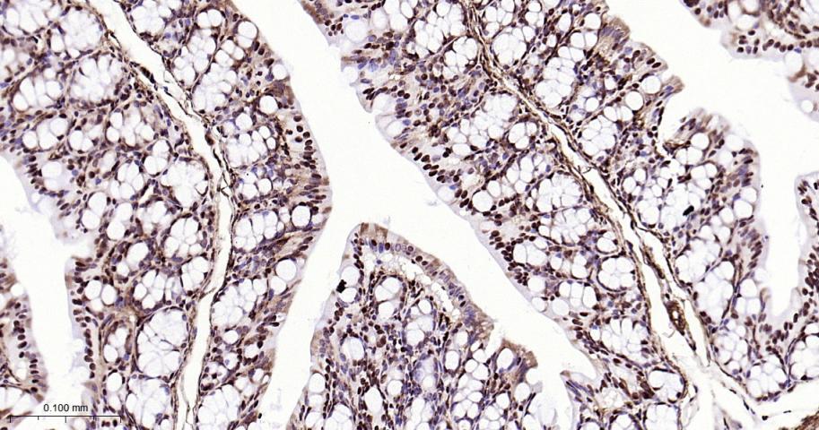 高迁移率族蛋白B1重组兔单抗