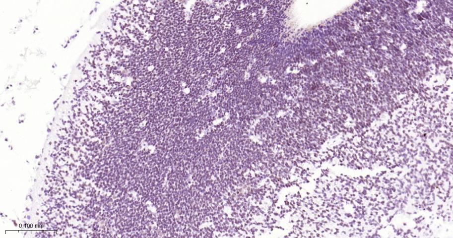 活化转录因子4重组兔单抗