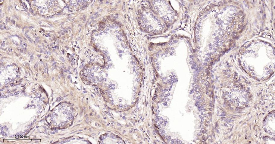 磷酸变位酶1重组兔单抗