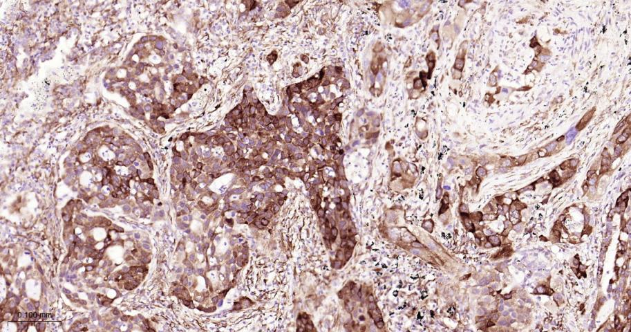 磷酸化真核启动因子2α抗体